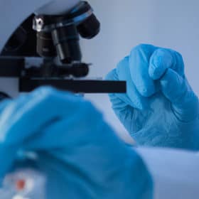 L’ergothionéine : un antioxydant à fort potentiel